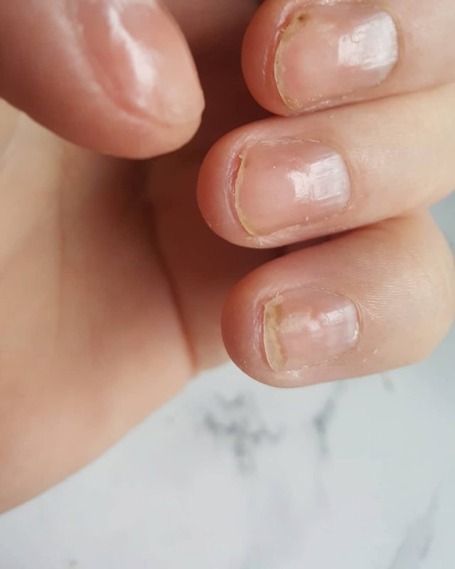 How to Fix Weak Nails